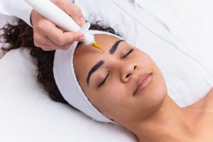 Despigmentador Jato de Plasma